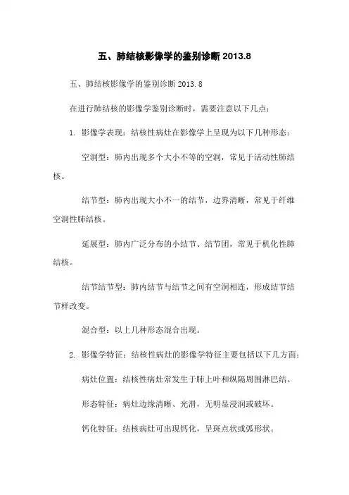 五、肺结核影像学的鉴别诊断2013.8