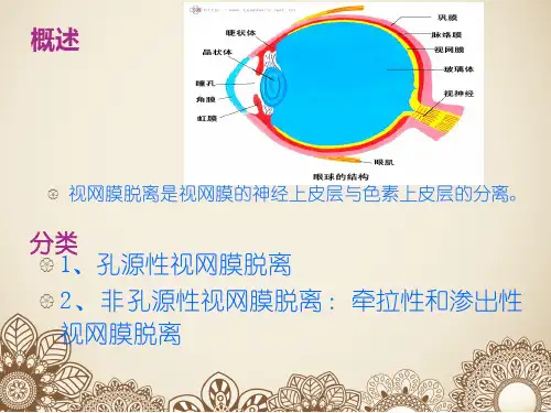 视网膜脱离术后护理ppt课件