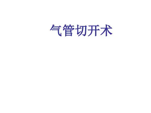 经皮微创气管切开术.ppt