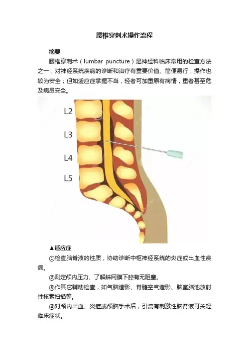 腰椎穿刺术操作流程