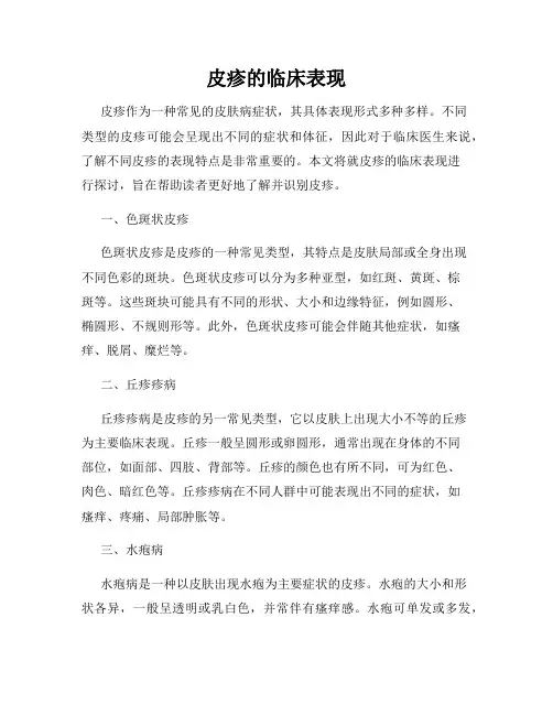 皮疹的临床表现