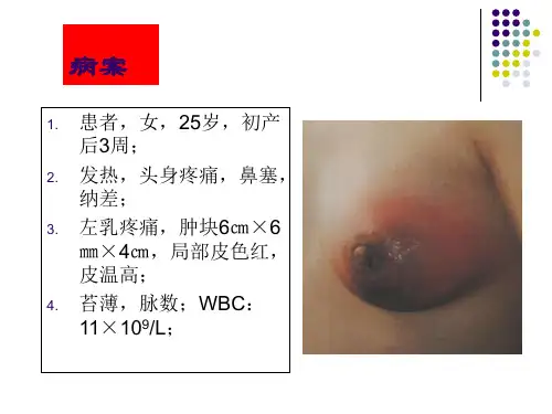 乳痈