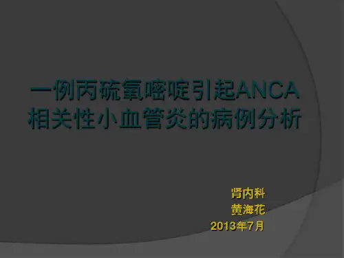一例丙硫氧嘧啶引起ANCA相关性小血管炎病例分析 黄海花