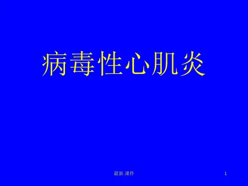 病毒性心肌炎完整版.ppt