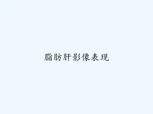 脂肪肝影像表现-PPT