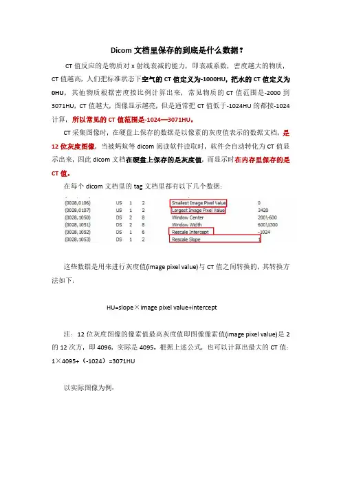 Dicom文档里保存的到底是什么数据