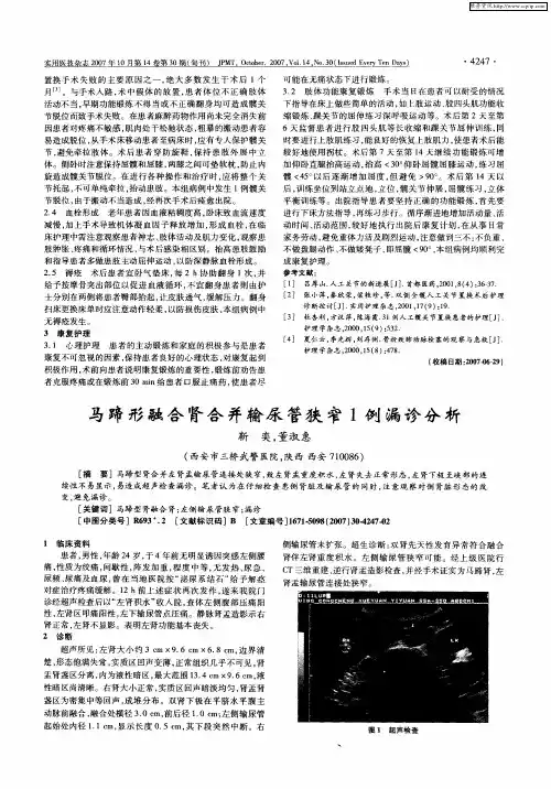马蹄形融合肾合并输尿管狭窄1例漏诊分析
