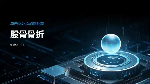 《股骨骨折》课件