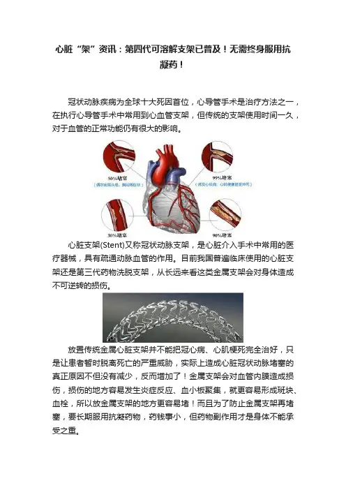 心脏“架”资讯：第四代可溶解支架已普及！无需终身服用抗凝药！