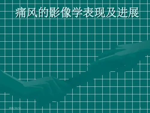 痛风的影像学表现及进展--何永胜