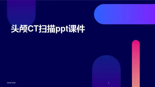 头颅CT扫描ppt课件-2024鲜版