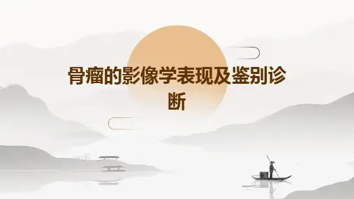 骨瘤的影像学表现及鉴别诊断