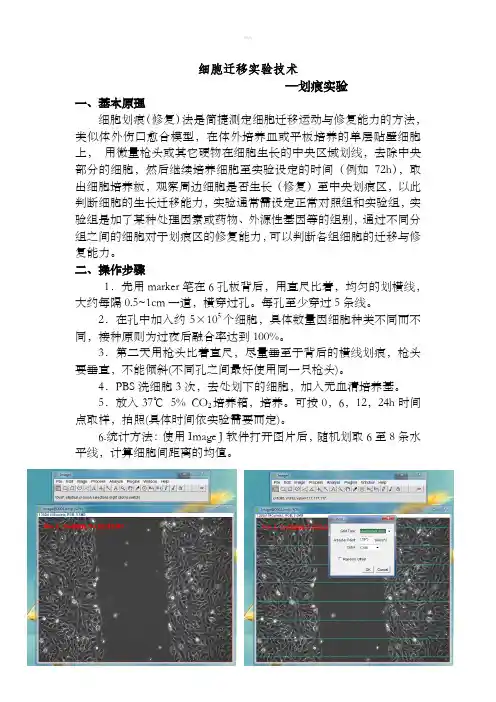 细胞迁移-划痕实验