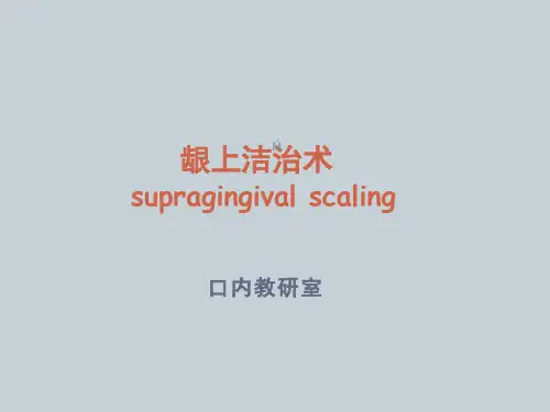 龈上洁治术ppt课件