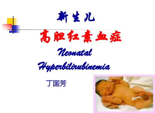 新生儿高胆红素血症详解PPT课件