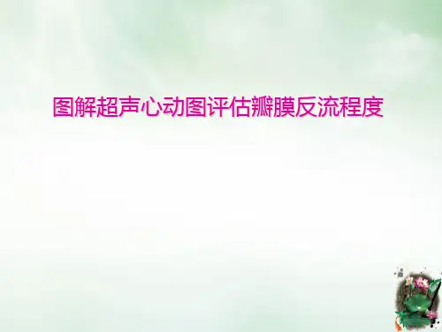 图解超声心动图评估瓣膜反流程度课件PPT