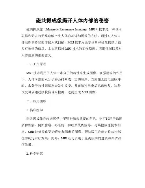 磁共振成像揭开人体内部的秘密