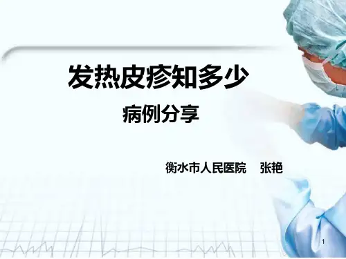发热皮疹知多少PPT课件