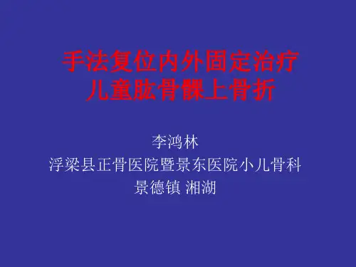手法复位内外固定治疗儿童肱骨髁上骨折