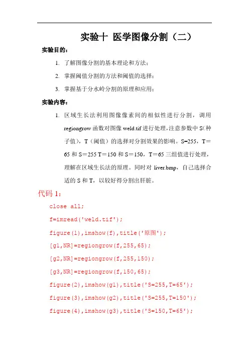 Matlab医学图像分割区域生长