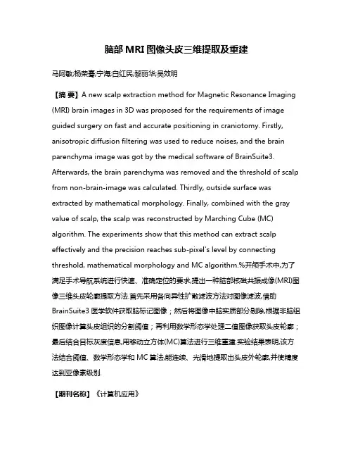 脑部MRI图像头皮三维提取及重建