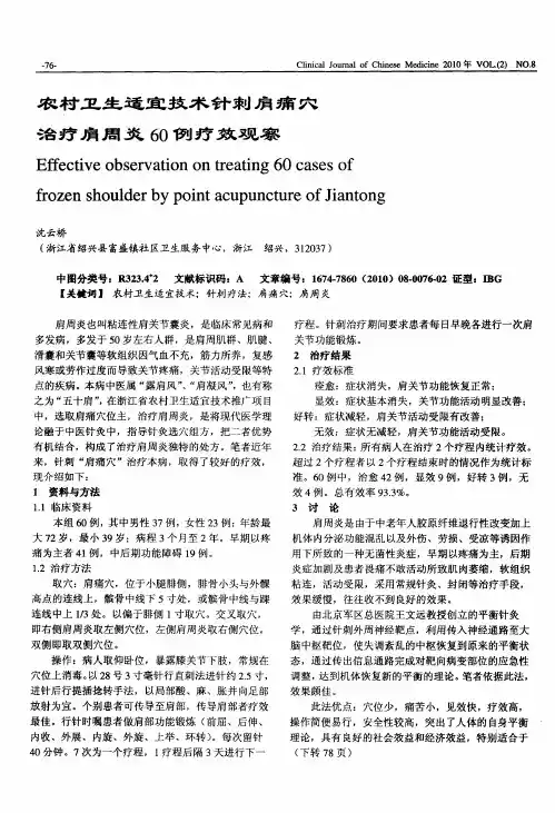 农村卫生适宜技术针刺肩痛穴治疗肩周炎60例疗效观察
