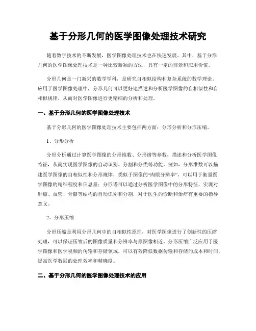 基于分形几何的医学图像处理技术研究