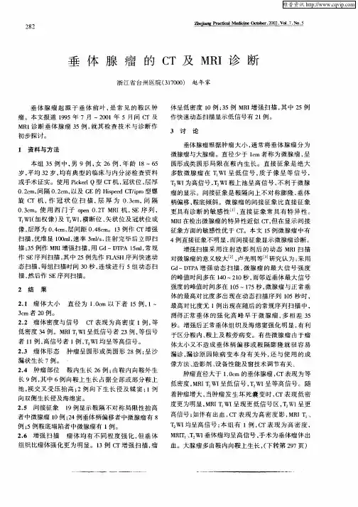 垂体腺瘤的CT及MRI诊断