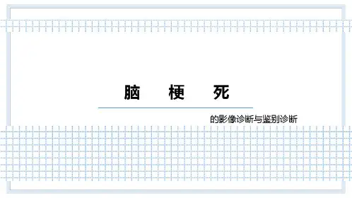 脑梗死的影像诊断与鉴别诊断