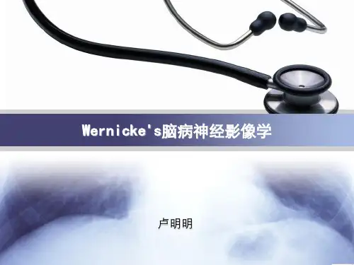 Wernicke脑病 CT表现