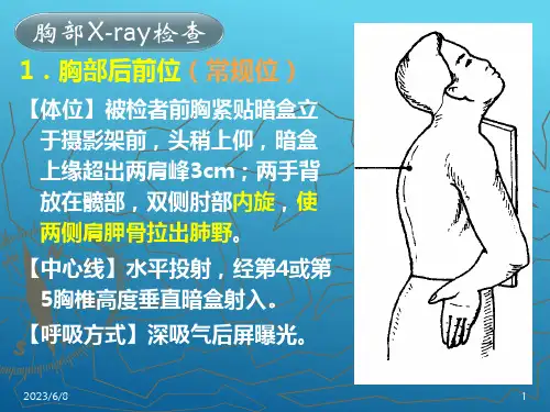 各部位X线摄影检查技术 胸部摄影