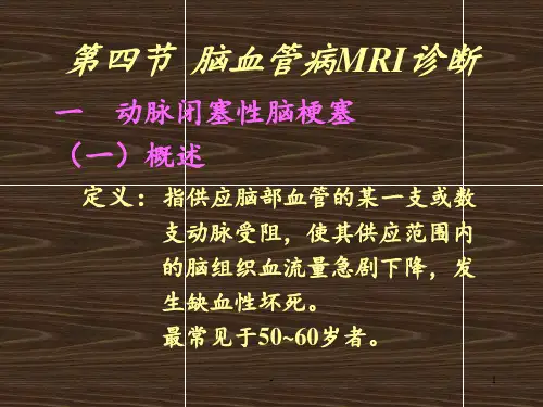 脑血管病的MR诊断PPT课件