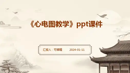 《心电图教学》PPT课件