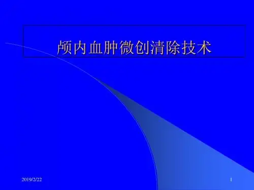 颅内血肿微创清除技术-精选文档