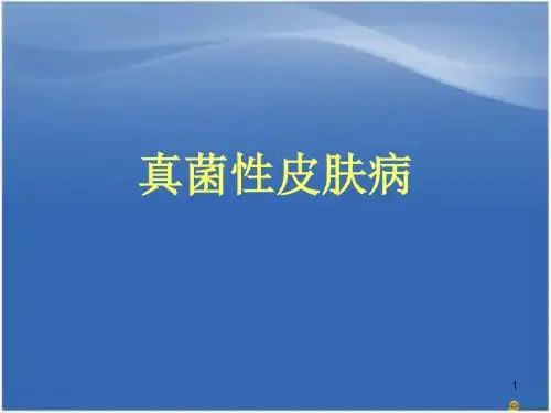 (推荐课件)真菌性皮肤病PPT幻灯片