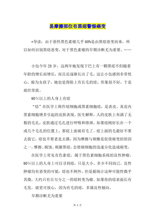 易摩擦部位有黑痣警惕癌变