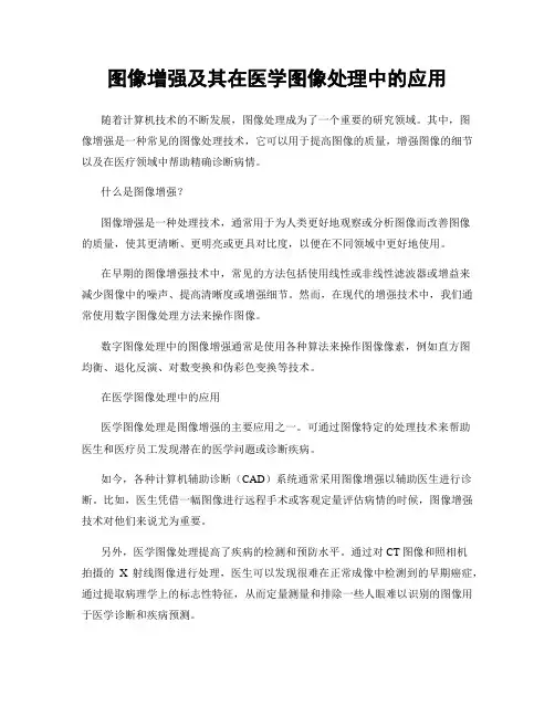 图像增强及其在医学图像处理中的应用