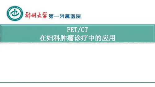 PET-CT在妇科肿瘤诊疗中的应用 (1)