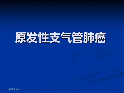 肺癌-最新版