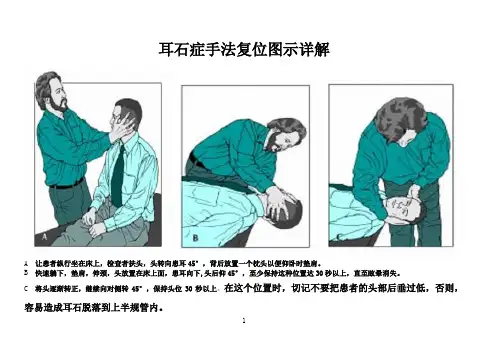 耳石症手法复位图示详解