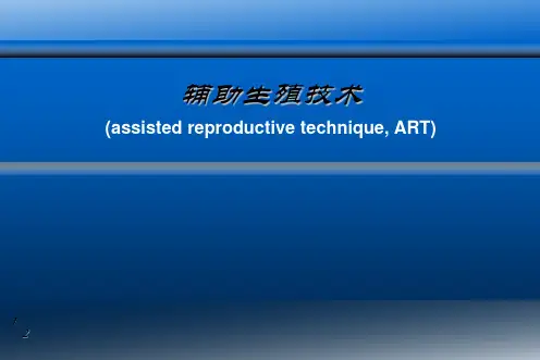 辅助生殖技术ppt课件