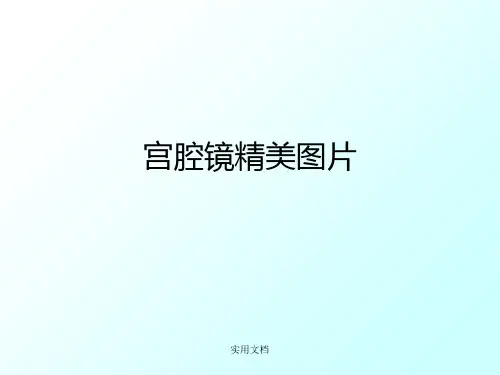 宫腔镜图片