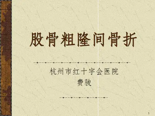 股骨粗隆间骨折ppt课件