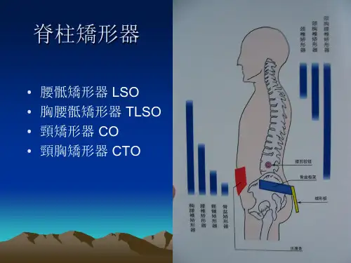 脊柱矫形器 PPT课件