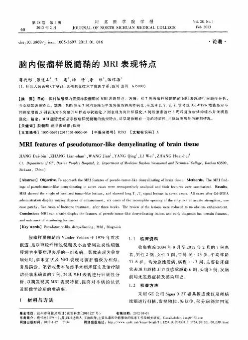 脑内假瘤样脱髓鞘的MRI表现特点