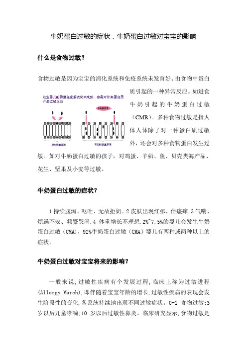 牛奶蛋白过敏的症状,牛奶蛋白过敏对宝宝的影响