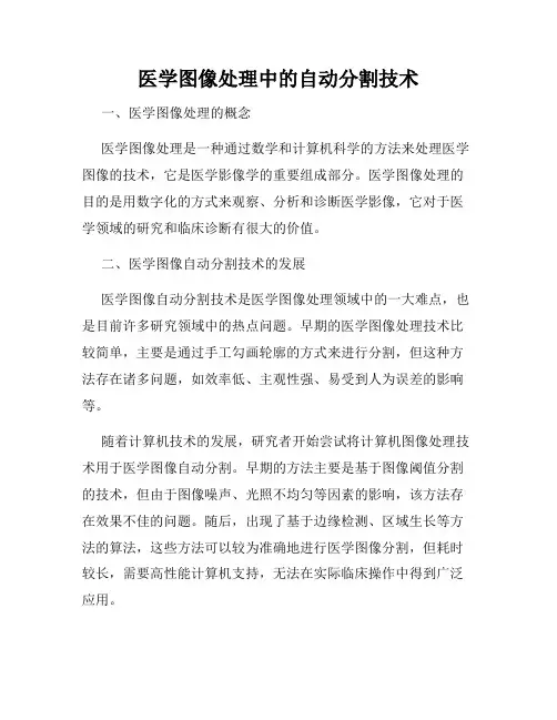 医学图像处理中的自动分割技术