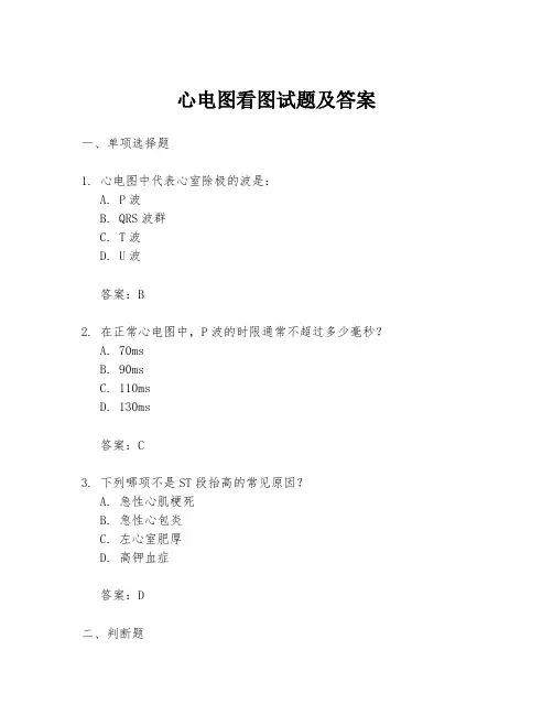 心电图看图试题及答案