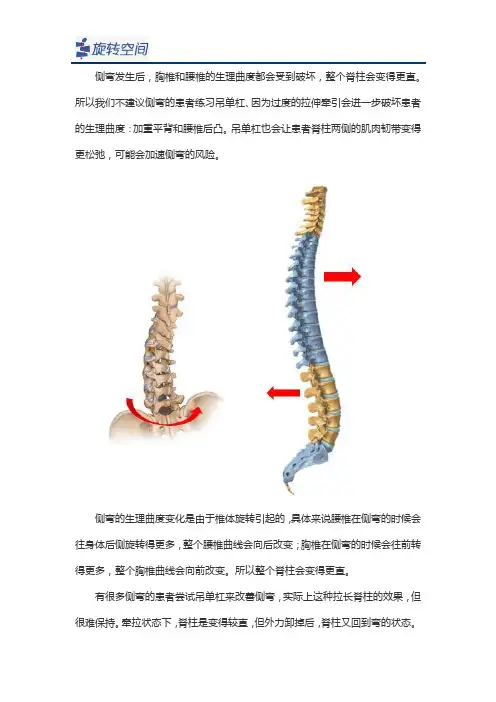 脊柱侧弯的孩子能吊单杠吗？