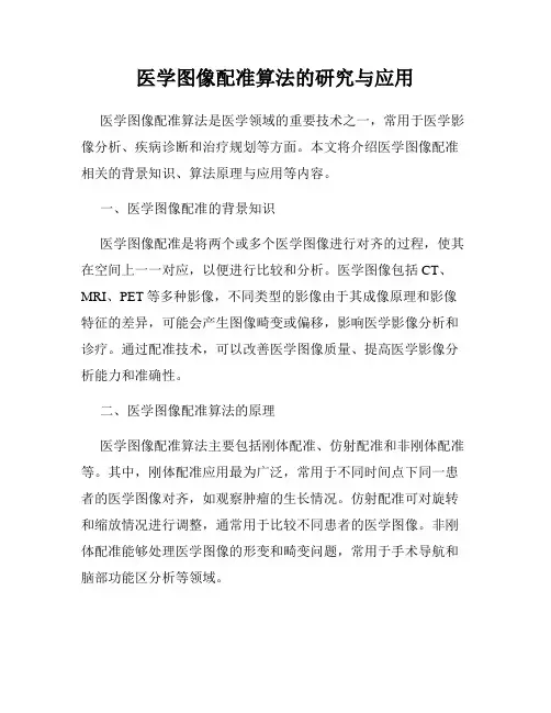 医学图像配准算法的研究与应用